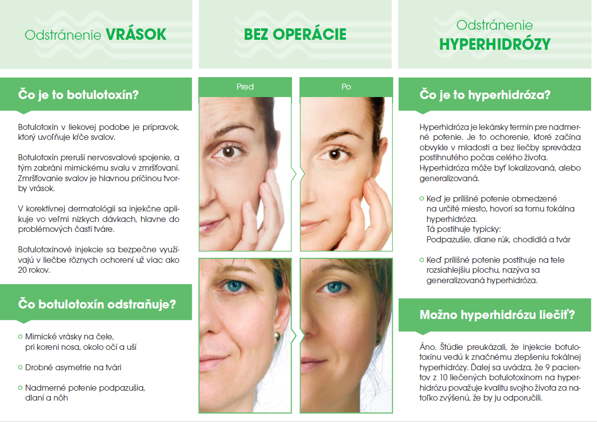 botox2.png